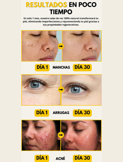 Evil Goods ® Original |Despidete de las manchas, acne y arrugas en menos de 1 mes con nuestro sebo de res 😱